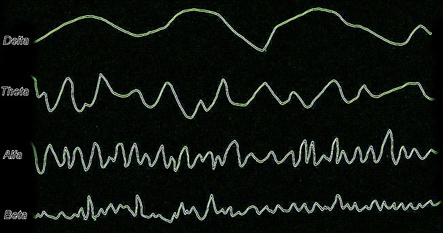 Registro de potenciales eléctricos en el cerebro