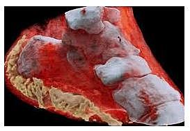 Radiografias a color