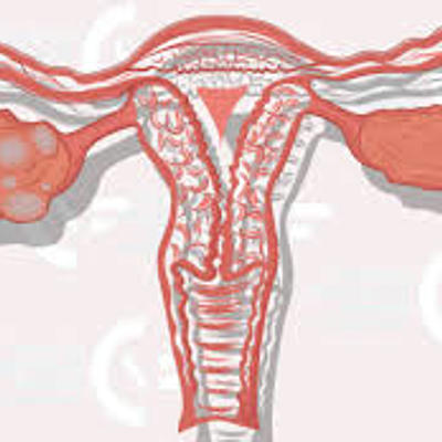 Timeline: linea del tiempo ovario poliquístico