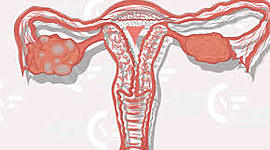 Timeline: linea del tiempo ovario poliquístico