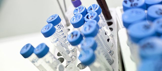 Primera vacuna preventiva contra el VIH