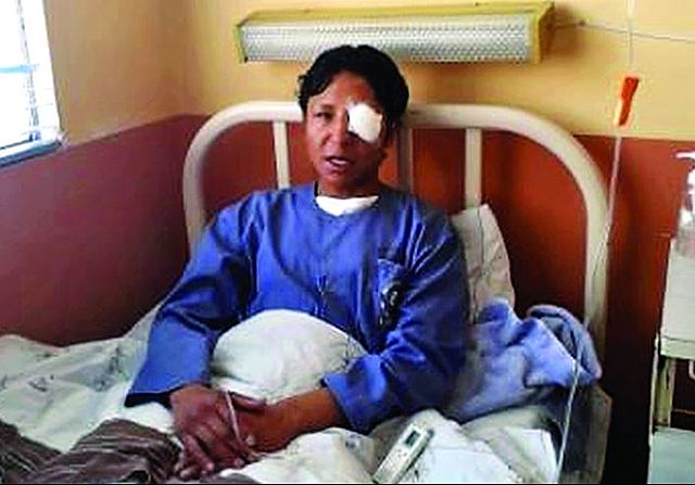 Un joven perdió el ojo izquierdo y otro estudiante, tres dedos