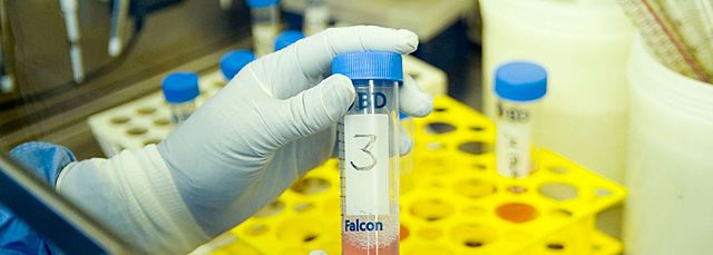 Identificació de les respostes dels limfòcits T