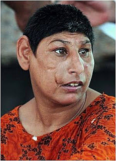 Comienzo de enfermedades...