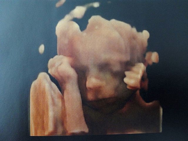 Mi primera foto en la barriga de mi madre