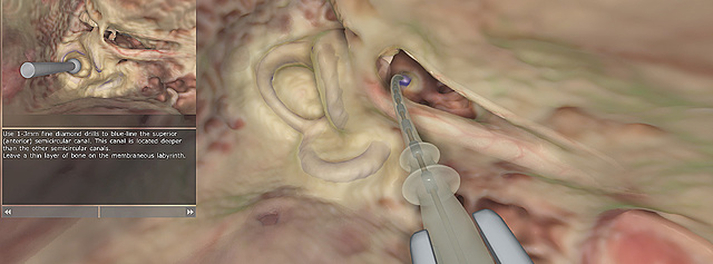 Virtual temporal bone