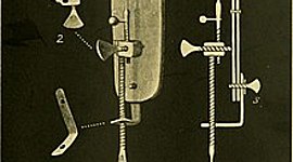 Timeline: Хронология развития микроскопа