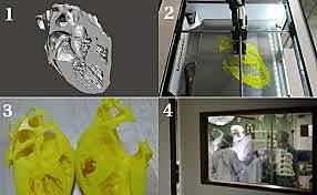 Impresión 3D en cirugía