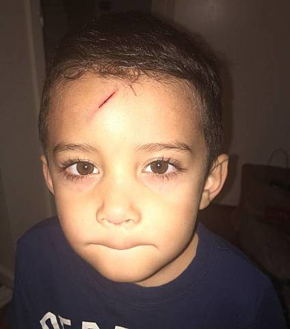 Me golpeé la frente