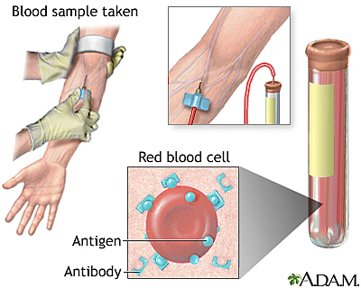 Antibody Tests are Out