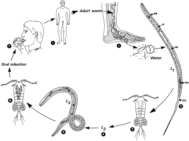 Drancunculus medinensis