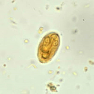 Giardia
