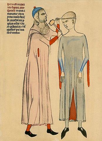 Desarrollo de la Trepanación, Frugardi de Salermo