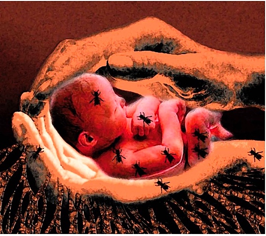 A child who born with the tail of a pig.