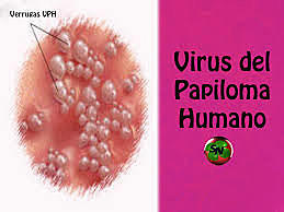 Evaluación de la implementación de las tres fases de la vacunación (2012-2014) contra el virus del papiloma humano en niñas nacidas desde el 2003 hasta el 2005 en el municipio de Manizales Colombia