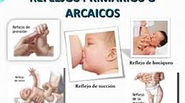 Timeline: LOS REFLEJOS