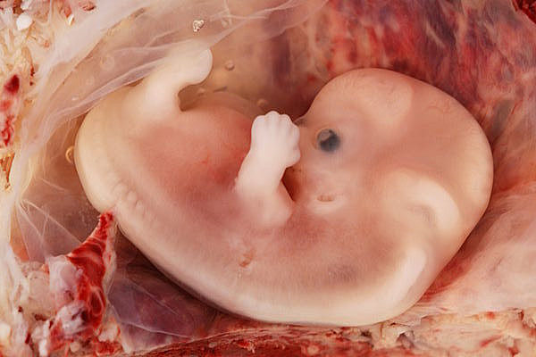 8th week - Embryonic Period
