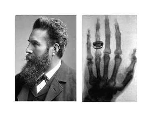 Primer uso de la radiación ionizante