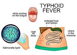 Typhoid Vaccine created...
