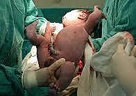 NACIMIENTO DE SEBASTIAN