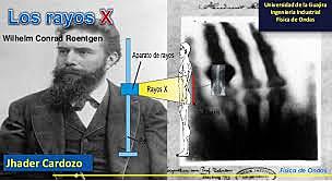 Wilhem Conrad Rontgen