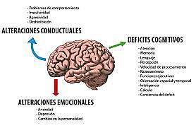 Primera mitad del siglo XX. Orientación de Neuropsicología