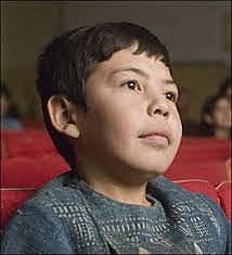 Hassan Gets Plastic Surgery