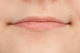 Hassan's Lip Surgery