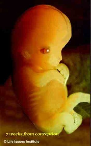 Supreme Court Rules to Legalize Abortion in the Roe vs. Wade Case