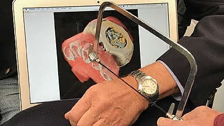 First Human Color X-Ray Scanner