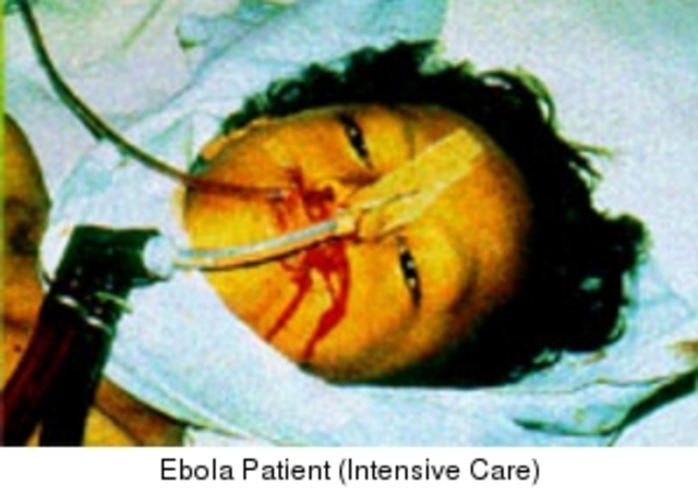 ebola, death toll 284