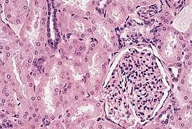 Micoscope électronique à transmission