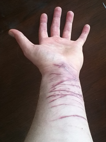 Sohrab tried to commit suicide