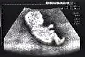 embarazo de mi primera princesa