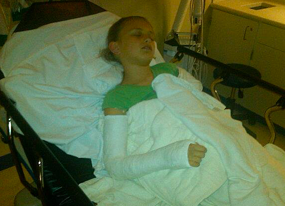 Broke My Arm