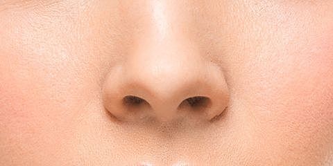 Em vaig trencar el nas i me'l van haver de recol·locar!!!