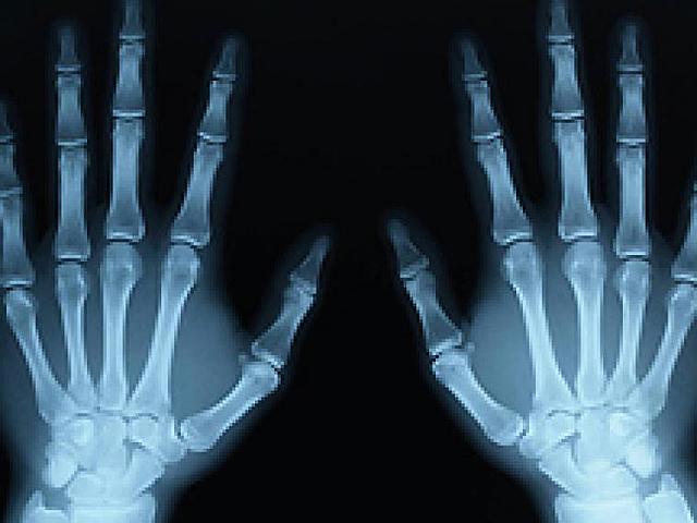 Descubrimiento de rayos X