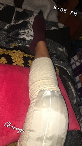 first time getting surgery