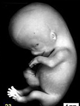 Embryonic Period - Week 8