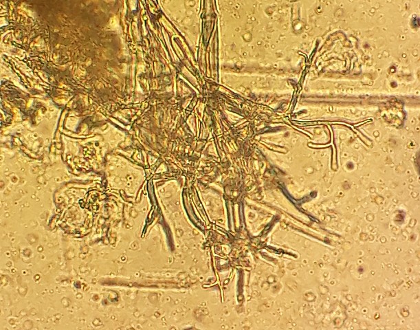 Pseudoperonospora