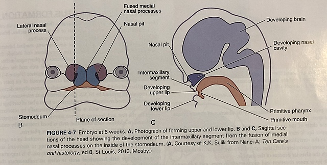 Embryonic Period: Sixth Week