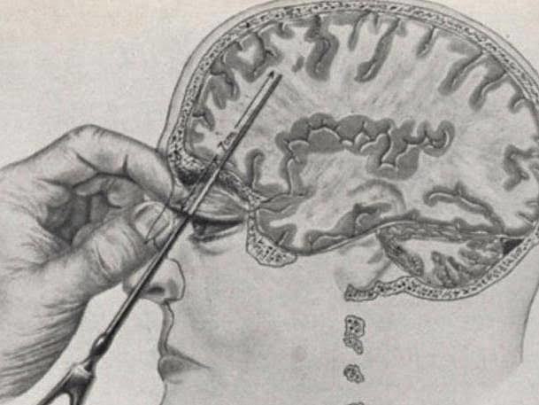 Tratamientos innovadores