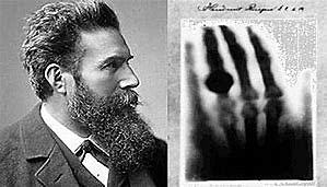 Primera fotografía con rayos X por Röntgen