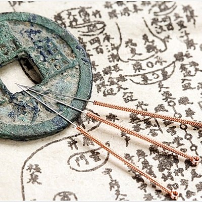 Timeline: la acupuntura en la historia