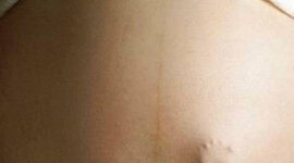 Timeline: Era of Activism