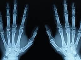 Wilhelm Roentgen descubrir los rayos X