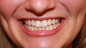 i got all my grown up teeth