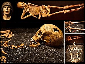 Life threatening 1610