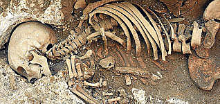 Métodos y fuentes usados en la paleopatología