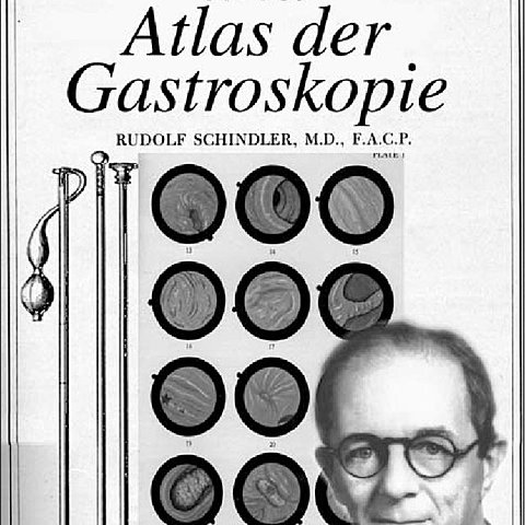 Rudolf Schindler construyó un gastroscopio articulado.